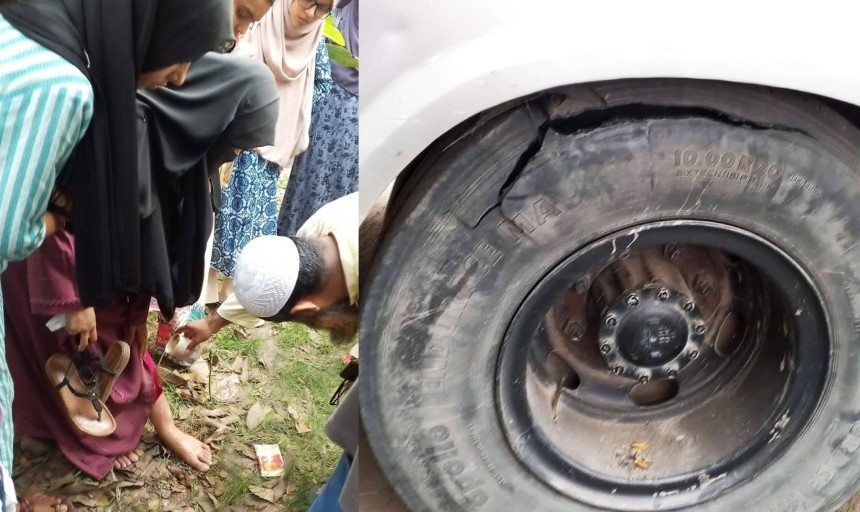 চাকা বিস্ফোরিত হয়ে কুমিল্লা বিশ্ববিদ্যালয়ের স্টাফ বাস দুর্ঘটনা, এক ছাত্রী আহত